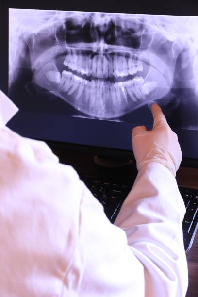 Best Emergency Tooth Extraction in Troutdale, OR
